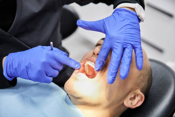 Best Broken or Cracked Tooth Emergency Dentist in USA